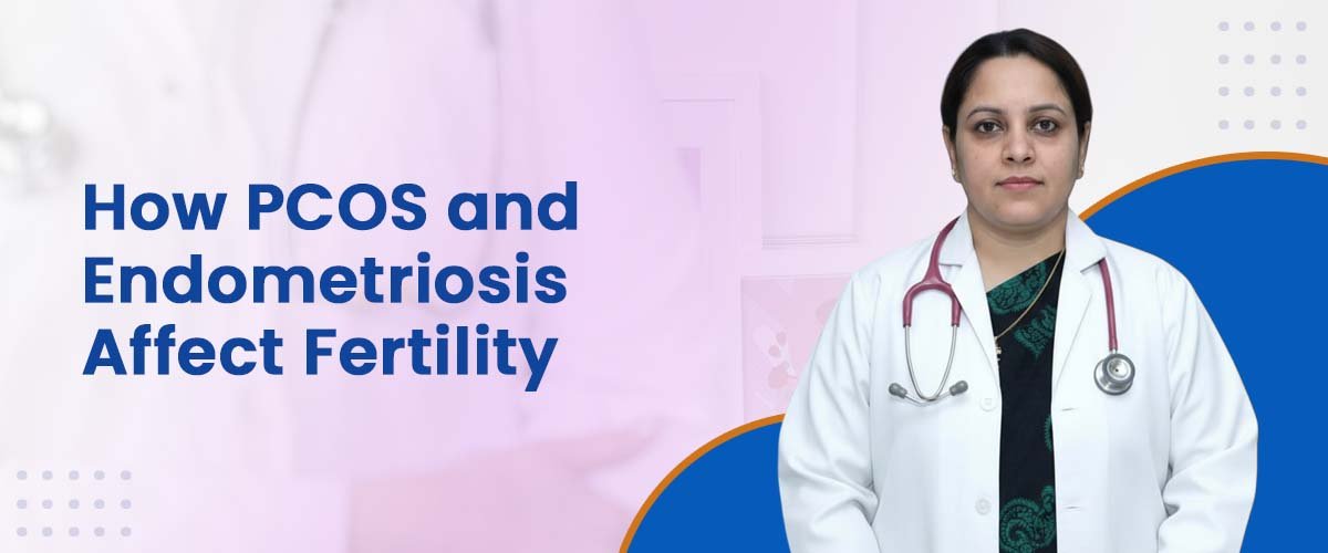 How PCOS and Endometriosis Affect Fertility